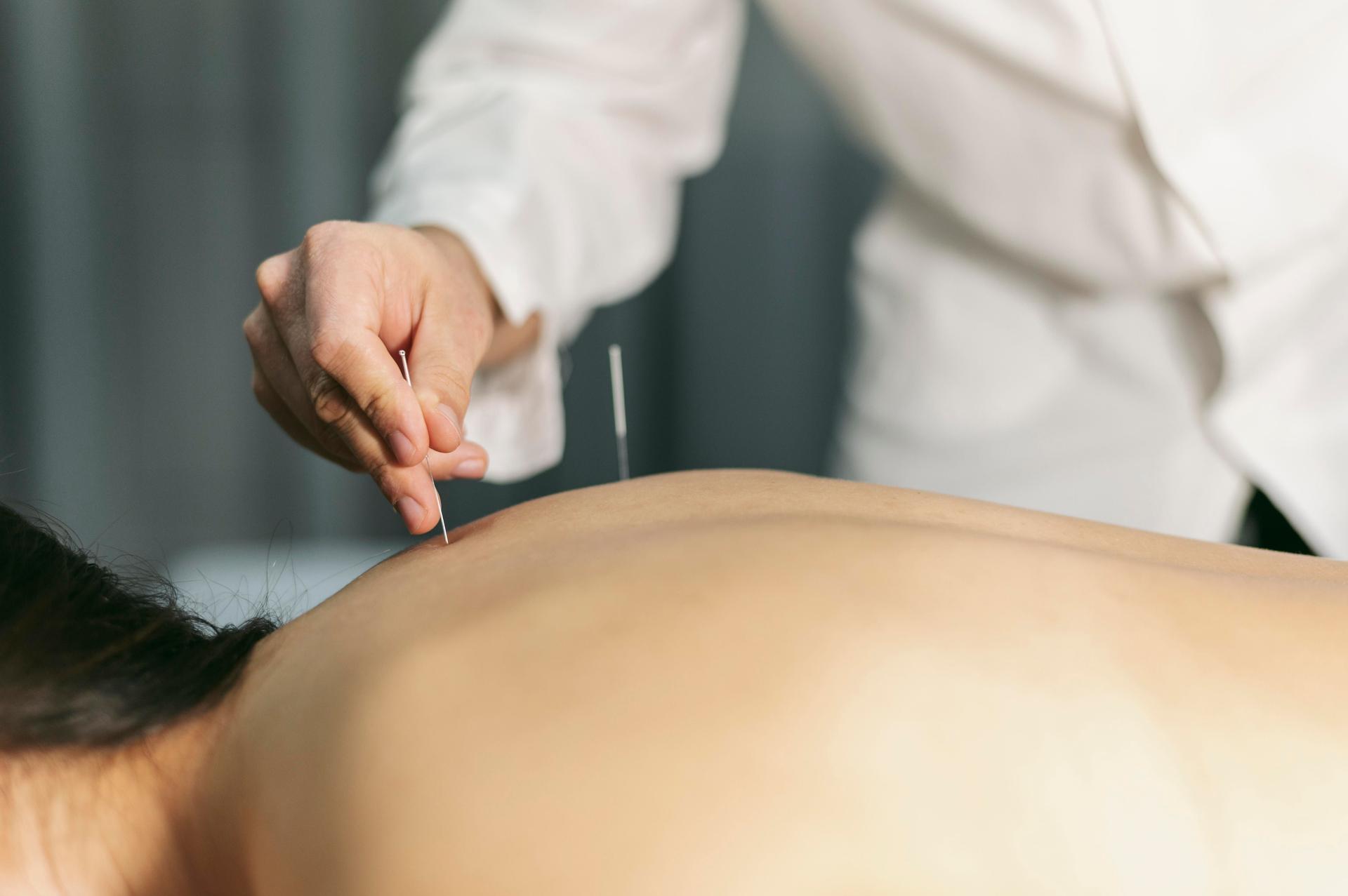 Séance d'acupuncture : insertion d'une aiguille fine dans le dos d'une personne allongée pour stimuler des points énergétiques et favoriser le bien-être.